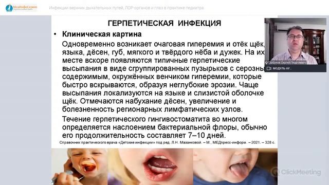 Инфекции верхних дыхательных путей, ЛОР-органов и глаз в практике педиатра. смотреть онлайн