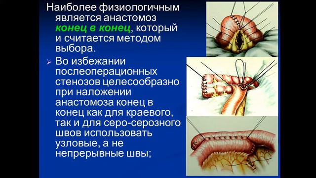 Лекция №8 Хирургическая анатомия брюшной полости и органов ЖКТ смотреть онлайн