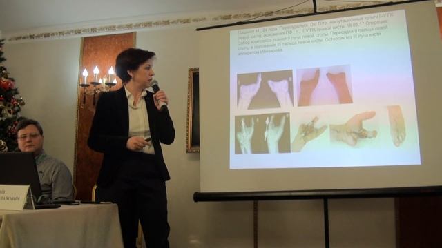 Реконструктивное вмешательство при заболеваниях и повреждениях кисти. смотреть онлайн