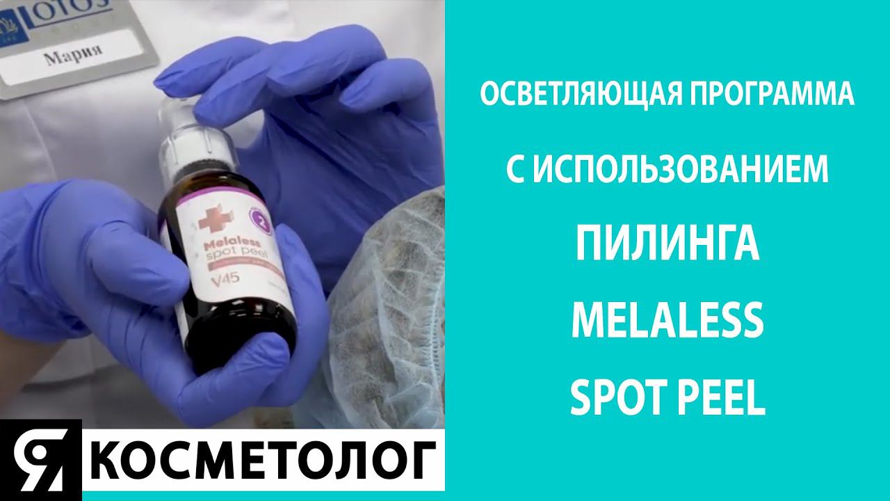 Осветление и предотвращение повторной гиперпигментации с всесезонным пилингом Melaless Spot Peel