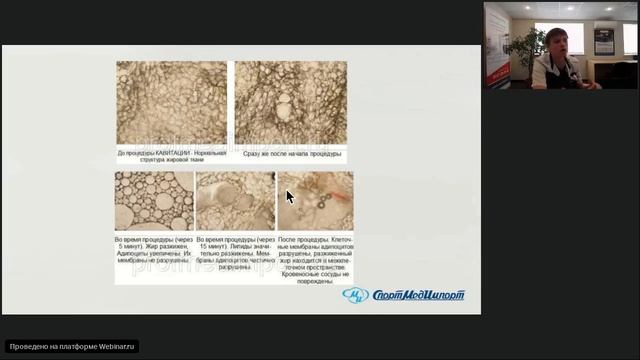 Жировые отложения смотреть онлайн