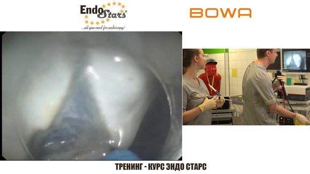 Эндоскопическая подслизистая диссекция (ESD).Эндоскопический курс. Эндо Старс (Endo Stars LLC). смотреть онлайн