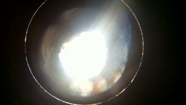 Ушной клещ (отодектоз). Паразиты плавают в вазелиновом масле. смотреть онлайн