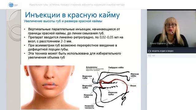 Запись вебинара: Идеальные губы: эстетика, процесс старения, варианты коррекции и выбор метода