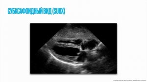 Как делать УЗИ если вы не умеете делать УЗИ (часть 2)