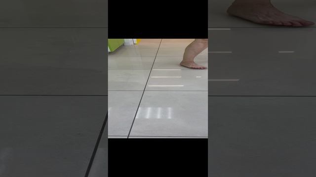 Как себя чувствует пациентка на 2-е сутки после операции. Флеболог Москва смотреть онлайн