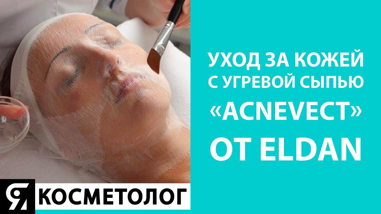 Уход за кожей с угревой сыпью «АКНЕВЕКТ» смотреть онлайн