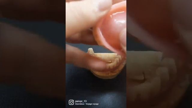 стоматолог,занимаюсь всем, что связано с зубами.Изготавливаю съемные зубные протезы и зубные коронк смотреть онлайн