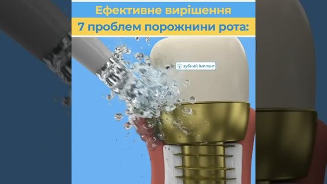 вирішення 7 проблем з іригатором Pecham смотреть онлайн