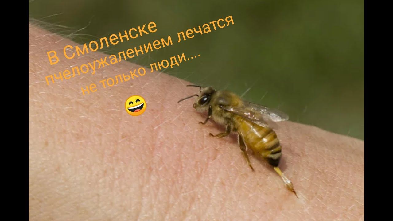 Пчелоужаление