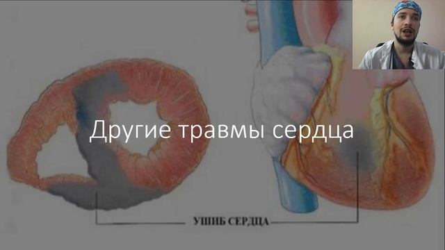Травма груди#2. Ищем: Певматоракс. Гемоторакс. Гемотампонада сердца. Перелом ребер и грудины. смотреть онлайн