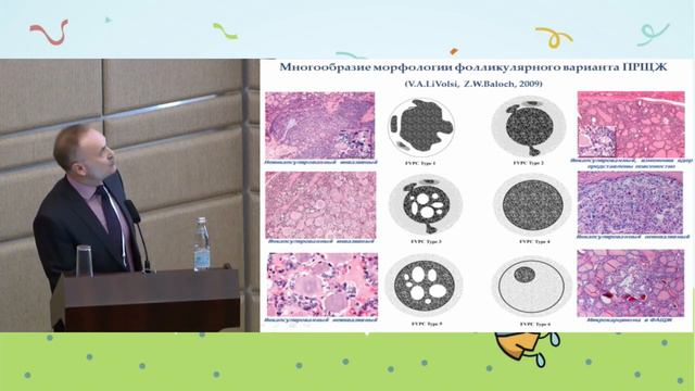 Морфологическая диагностика рака щитовидной железы смотреть онлайн