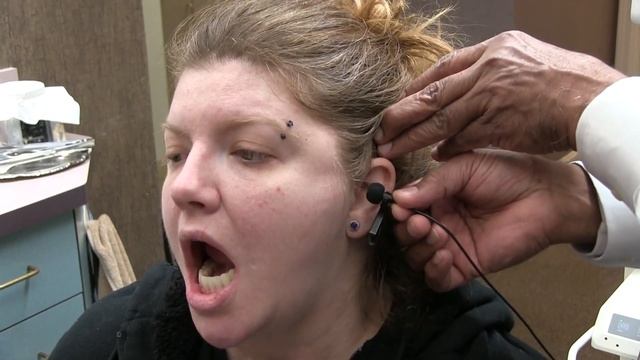 Years of jaw popping, clicking or locking corrected without surgery by Physiological NM Dentistry смотреть онлайн