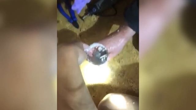 Палец застрял в насадке для погружного блендера: помогали работники МЧС смотреть онлайн