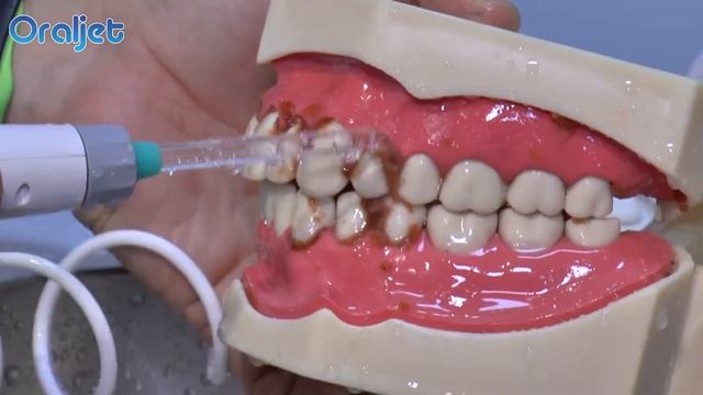 OralJet IN2017 смотреть онлайн