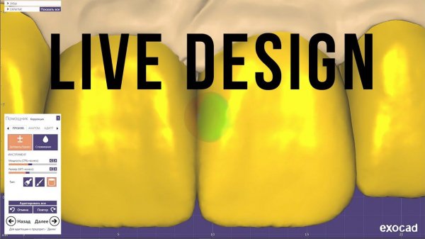 Live Exocad. Live Wax up. Mockup. Моделирование экзокад. зубной техник