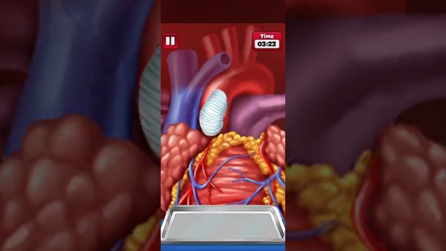 Open Heart Surgery Game Full Gameplay | Doctor Games смотреть онлайн