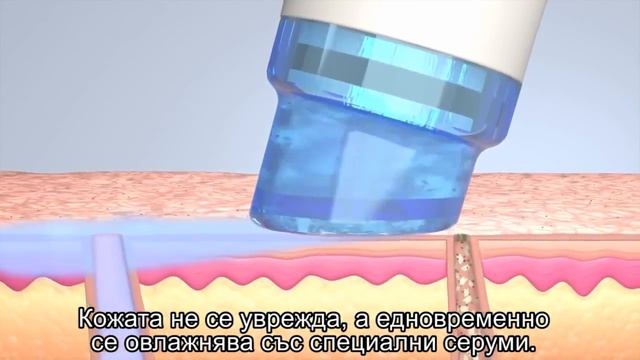 HydraFacial MD - Революция в почистването на лицето! Evolution Aesthetic & Laser Center смотреть онлайн