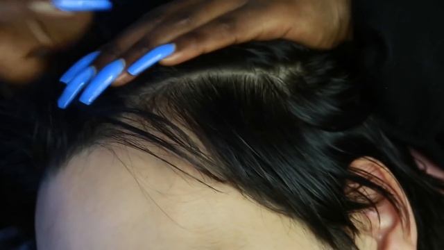 ASMR | AllZoomed Scalp Scratching with nails | Picking Whiteheads | Blowing & Brushing away смотреть онлайн