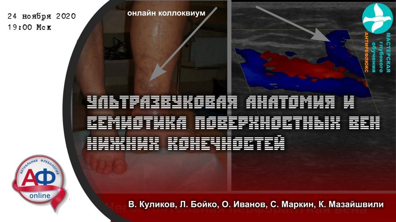 УЗ анатомия и семиотика поверхностных вен нижних конечностей смотреть онлайн