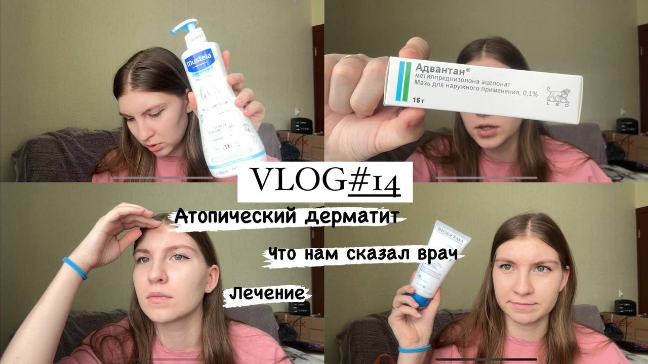 VLOG#14 АТОПИЧЕСКИЙ ДЕРМАТИТ? ЧТО НАМ СКАЗАЛ ВРАЧ. КАК ЛЕЧИТЬ?? смотреть онлайн