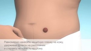 Защитная пленка стомы, (спрей) Brava (Coloplast), защита кожи при  отклеивания (кало\мочеприемника)