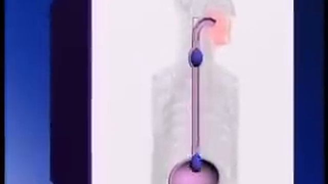 Como funciona a bomba peristáltica de mangote смотреть онлайн
