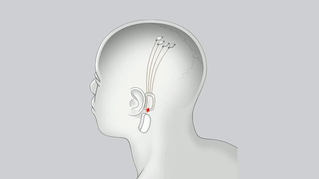 Илон Маск презентовал чипы для чтения мыслей смотреть онлайн