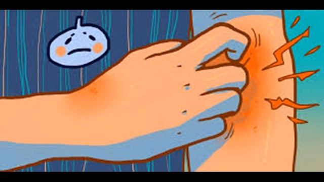 Экзема смотреть онлайн