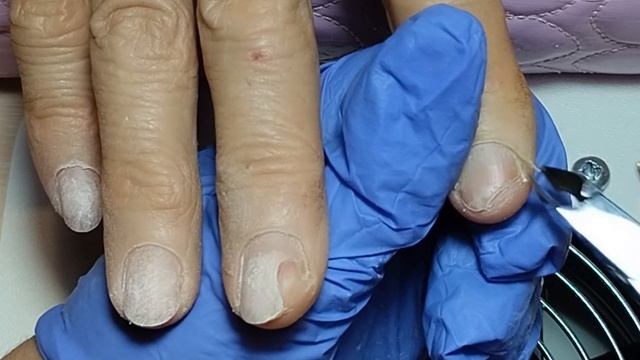 Онихолизис #shorts#nailart#nails смотреть онлайн