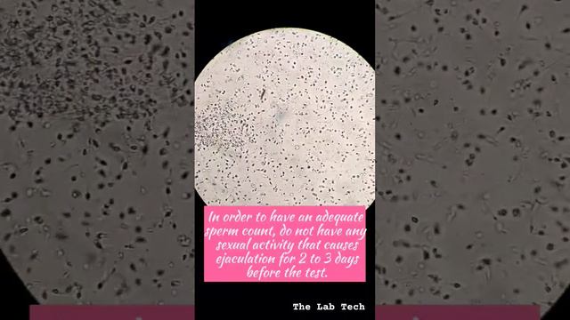 Semen Analysis or Sperm Count 🔬 #sperm #checkup #Thelabtech смотреть онлайн