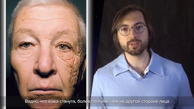 Ультрафиолет и кожа. Реальный клинический случай смотреть онлайн