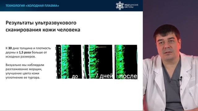 Холодная плазма смотреть онлайн