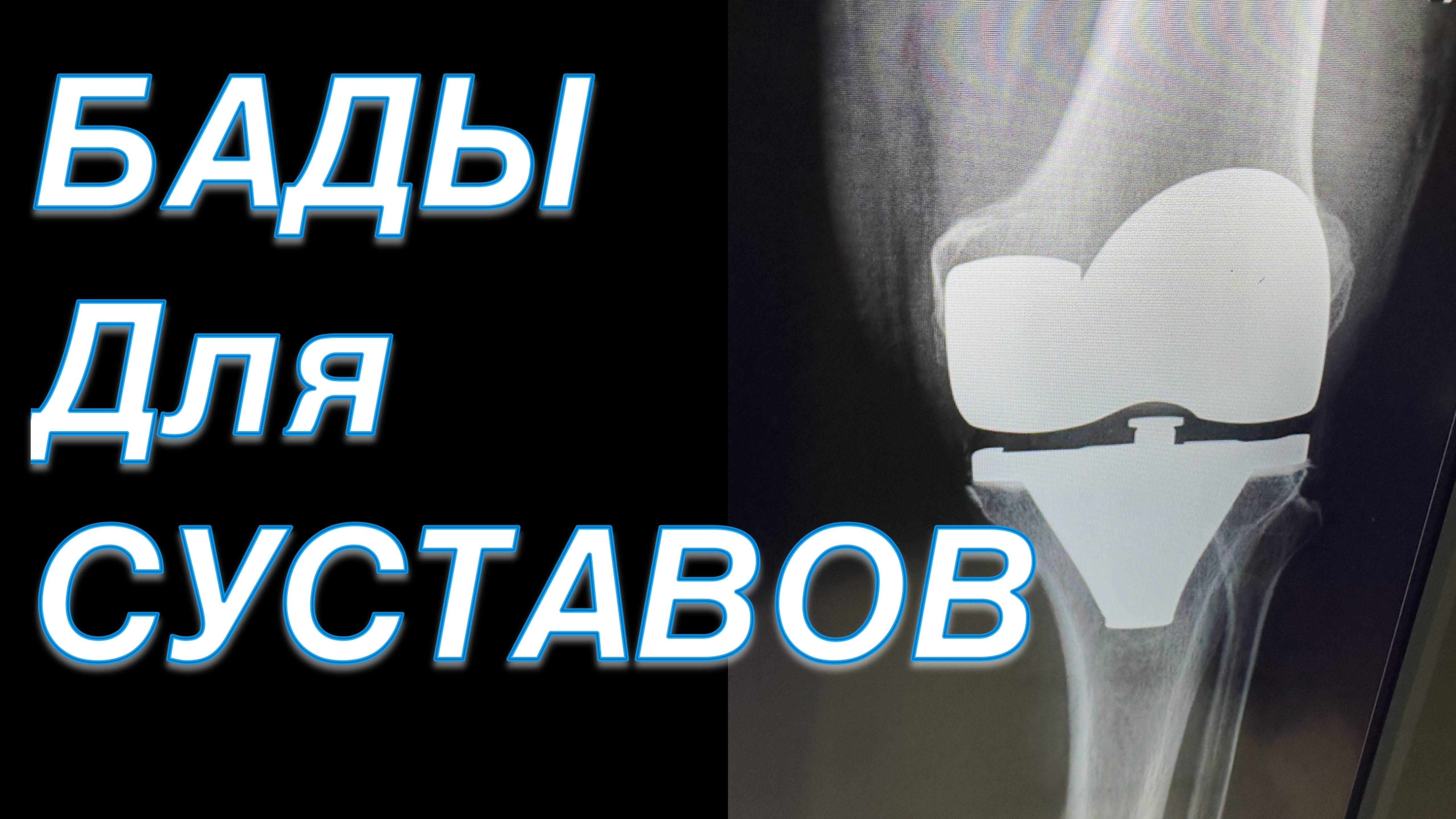 БАДЫ ДЛЯ СУСТАВОВ смотреть онлайн