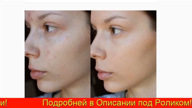 Тональный Крем Ламитон Lamiton Купить В Владивостоке смотреть онлайн