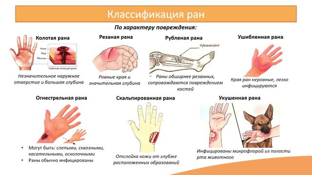 10.1. Раны. Раневые инфекции смотреть онлайн