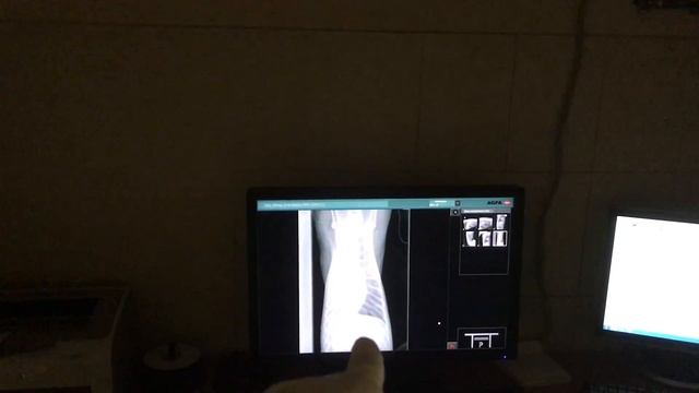 Thoracic x-ray. Dog positioning. Рентгенография грудной полости. Укладка собаки. смотреть онлайн