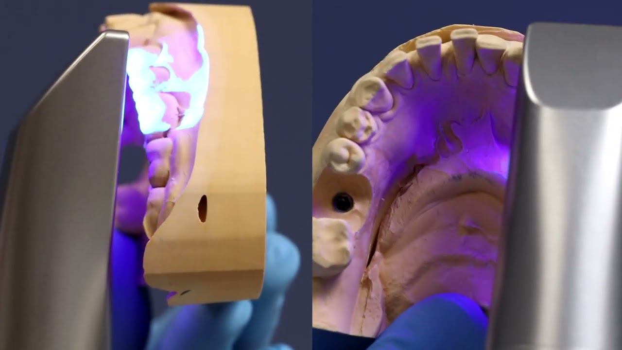 Цифровая стоматология Dentsply Sirona Cerec Клиника Екатерининская смотреть онлайн