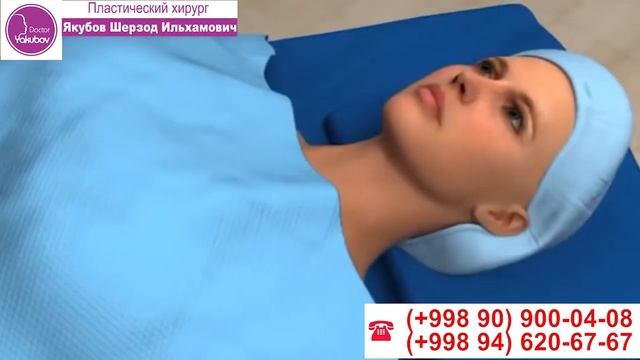 Пластика век в Ташкенте, Верхняя блефаропластика 35 смотреть онлайн