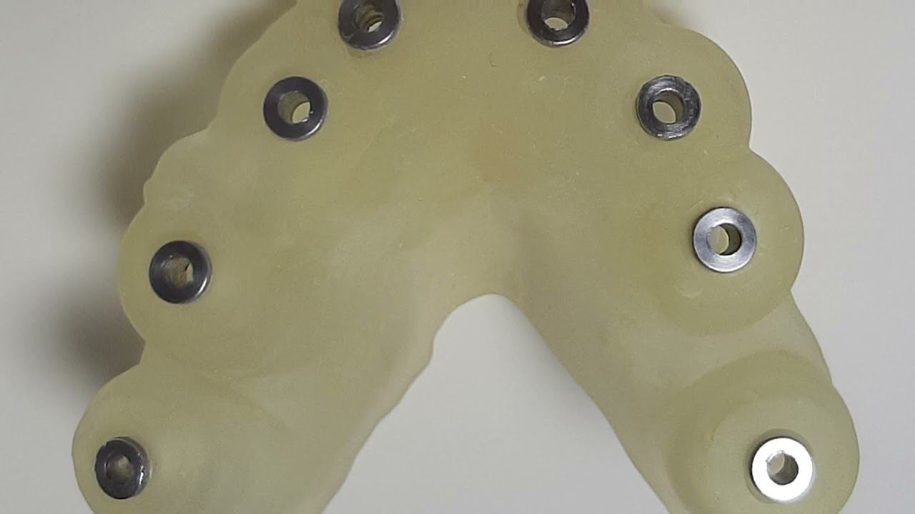 Протезирование на имплантатах по протоколу "Всё на 8" / Ортопед Бондаренко Юрий Иванович, Эстетикс смотреть онлайн