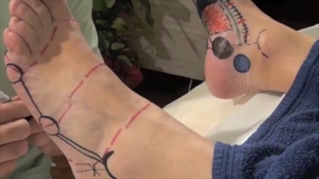 Аппликатор "Ляпко" Стельки и их механизмы действия на организм человека. смотреть онлайн