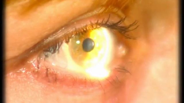 вот как оказывается подбирают цветные линзы :) смотреть онлайн