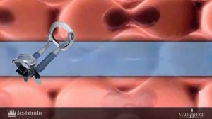 Экстендеры Jes Extender и Male Edge