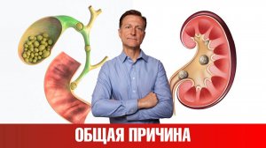 Главная причина камней в почках и камней в желчном пузыре👌