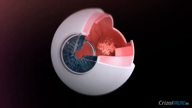 Компьютерные очки с линзами Crizal Prevencia