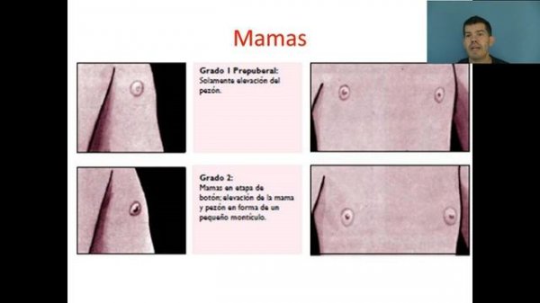 Pubertad Normal (2° Parte)