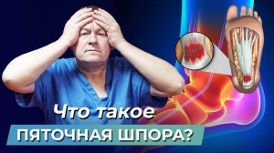 ЧТО ТАКОЕ ПЯТОЧНАЯ ШПОРА? Лучший способ БЫСТРО СНЯТЬ БОЛЬ и избавиться от дискомфорта!
