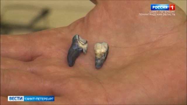 В Педиатрическом университете разработали инновационный состав для лечения зубов смотреть онлайн