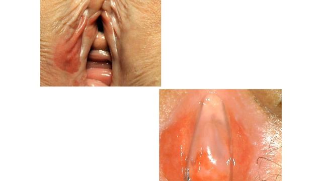 Менопаузальный генито-уринарный синдром, междисциплинарные парадигмы общения.