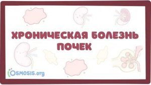Хроническая Болезнь Почек (ХБП, ХПН) - причины, симптомы, клиника, лечение (лекция)